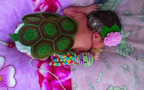 Terapia neonatal: Tortuguitas acompa�an el apego a la vida