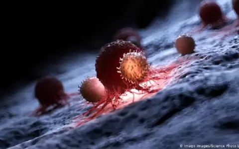 Estudio israel� avanza en caracterizar las c�lulas cancerosas