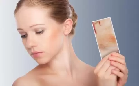 Dermatitis at�pica y los cuidados de la piel