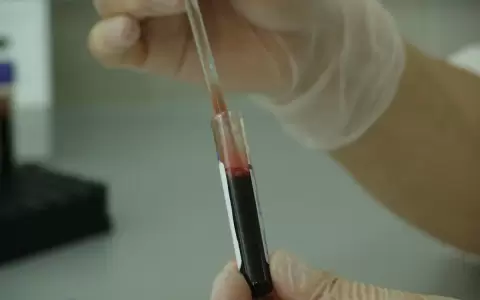 �Sab�as que cada 35 segundos alguien es diagnosticado con c�ncer en la sangre?