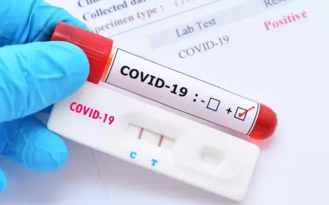 Fallecimientos por Covid-19 en Paraguay ascienden a 9.498
