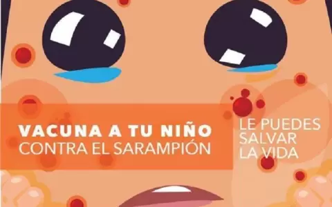 Instan a proteger a la familia con la vacuna contra el sarampi�n