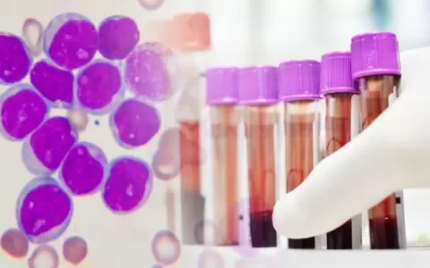 En el D�a Mundial de las Leucemias Cr�nicas, FUNCA invita a webinar hematol�gico