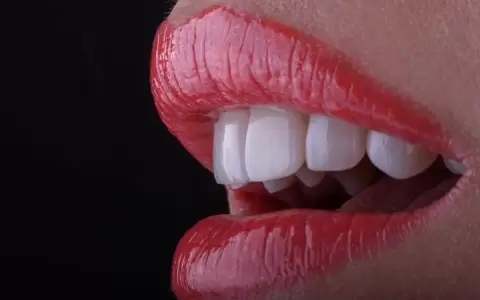 Sonrisas de dise�o, la salud que da belleza