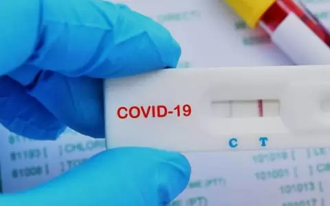Autorreporte Covid-19: �c�mo y d�nde hacerlo?