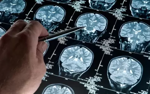 Un software de desarrollo argentino podr�a diagnosticar de forma precoz el Alzheimer