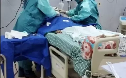 Reportan ni�os con cuadros agudos de Covid-19 de padres no vacunados
