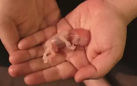 Alemania levanta la prohibici�n de publicitar el aborto