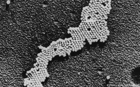 Detectan rastros de poliovirus en aguas residuales de Londres