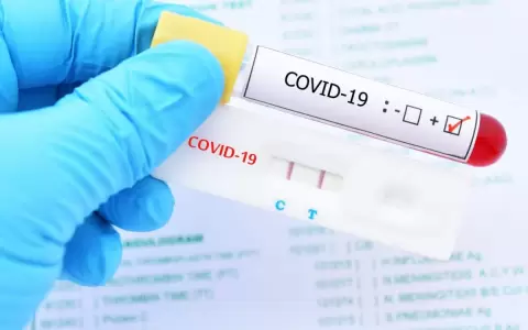 Se duplica demanda de test Covid en nueva ola de la pandemia