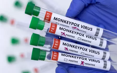 La expansi�n de la viruela del mono empuja a la OMS a decidir si es una emergencia internacional