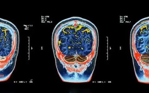 Un estudio revel� c�mo el aislamiento social disminuye las capacidades cerebrales