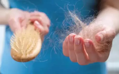 Alopecia areata: qui�nes se pueden beneficiar con el nuevo medicamento