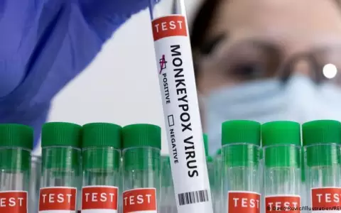 La OMS declara emergencia internacional por viruela del mono