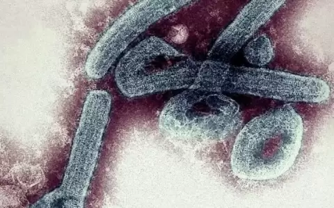Activan protoclo contra el brote de virus del ebola.
