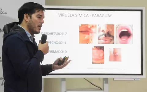 Paraguay no tiene casos confirmados de viruela del mono