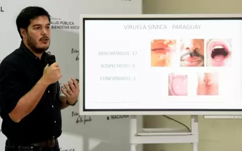 Salud prev� vacunas contra viruela del mono