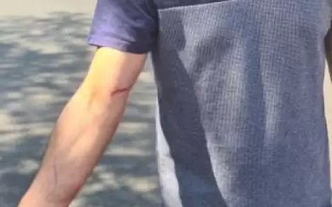 Diputado denunci� haber sido agredido durante manifestaci�n en CDE