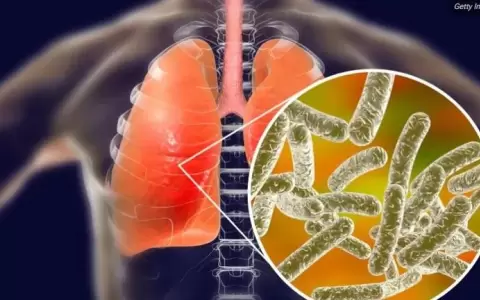 Legionella: el extra�o virus que brot� en Argentina