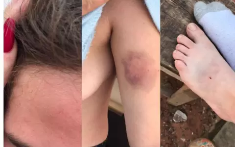 Mujer denuncia brutal agresi�n, robo y abuso sexual