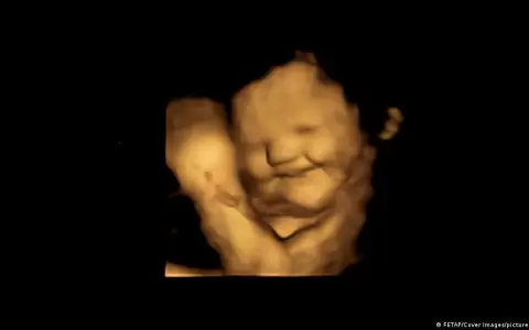 Estudio confirma evidencia de que beb�s reaccionan al gusto y olfato desde el �tero