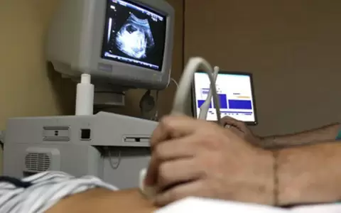�Qu� es la incompatibilidad de Rh madre/hijo?