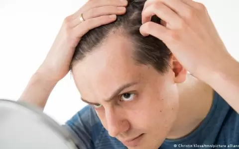 Cient�ficos japoneses logran producir fol�culos de cabello en laboratorio