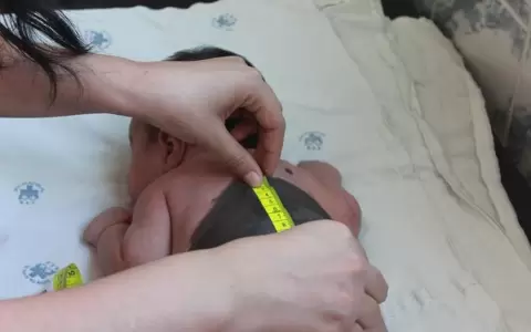 Ofrecen controles gratuitos de manchas y lunares a ni�os en el Acosta �u