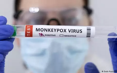 OMS cambia el nombre a la viruela del mono: ahora se llama mpox