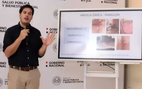Viruela s�mica: Paraguay es el pa�s de la regi�n con menor �ndice de casos positivos