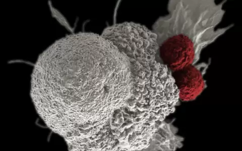 Dos experimentos de biolog�a sint�tica iluminan el camino de los futuros tratamientos contra el c�ncer