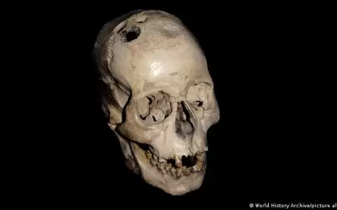 Estudio revela que la cirug�a cerebral se remonta a la Edad de Bronce