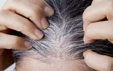 Alimentos que retrasan la aparici�n de las canas