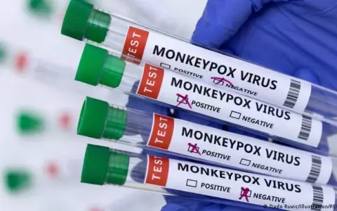 Esta semana, Paraguay no registra nuevos casos de viruela de mono