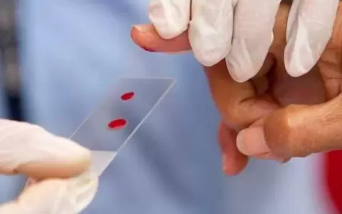 Hemofilia: enfermedad sin cura, pero el tratamiento cambia la vida de pacientes