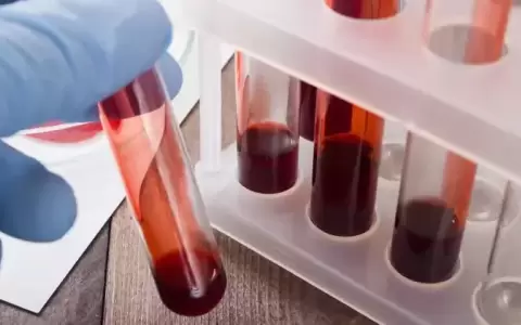M�dicos abogan por la concientizaci�n acerca de los tipos de c�ncer de la sangre