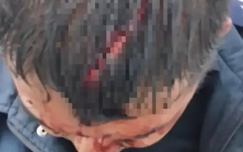 Hombre acusado de violencia familiar agredi� a polic�a que lo detuvo