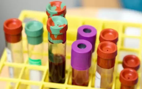 Este test de sangre detecta m�s de 50 tipos de c�ncer y su localizaci�n