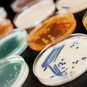 Confirman en Paraguay la presencia de una "superbacteria" resistente a antibi�ticos