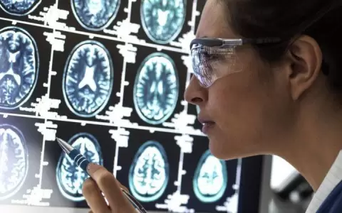 Descubren c�mo mueren las c�lulas cerebrales en la enfermedad de alzh�imer