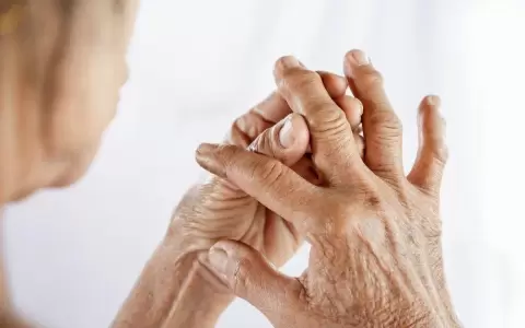 Artritis reumatoidea y el fr�o.