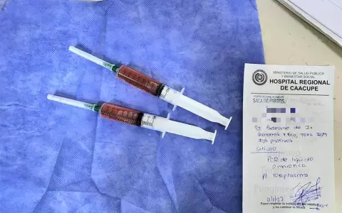 El Hospital Regional de Caacup� realiz� exitosamente su primera amniocentesis