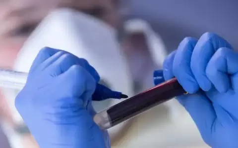 Un nuevo test indica la edad biol�gica de los �rganos