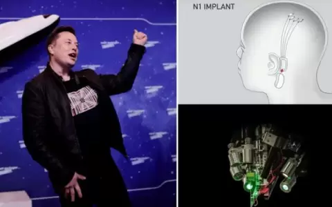 Elon Musk confirm� que Neuralink implant� un chip cerebral por primera vez en un ser humano
