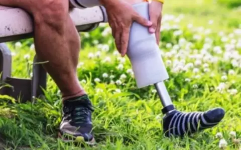 La diabetes est� provocando una crisis de amputaciones en hombres latinos: �qu� pasa?