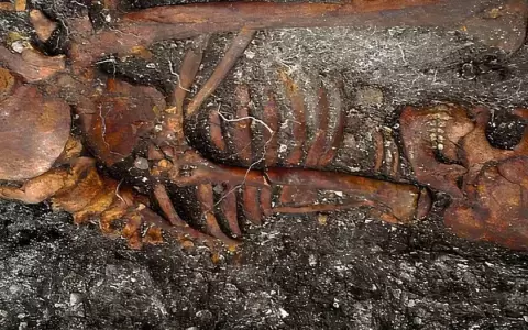 Bacteria de la s�filis ya exist�a en Brasil hace dos mil a�os