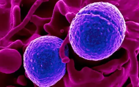 F�rmacos para el colesterol tambi�n matan c�lulas vasculares