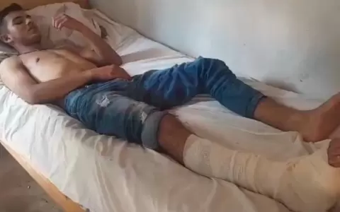 Joven qued� gravemente herido por delincuentes que se llevaron su motocicleta