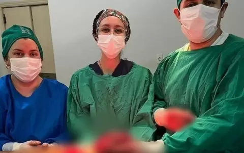 Extraen gran tumor del rostro a un paciente de 67 a�os en Misiones