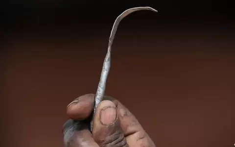 Millones sobreviven a la mutilaci�n genital en el mundo